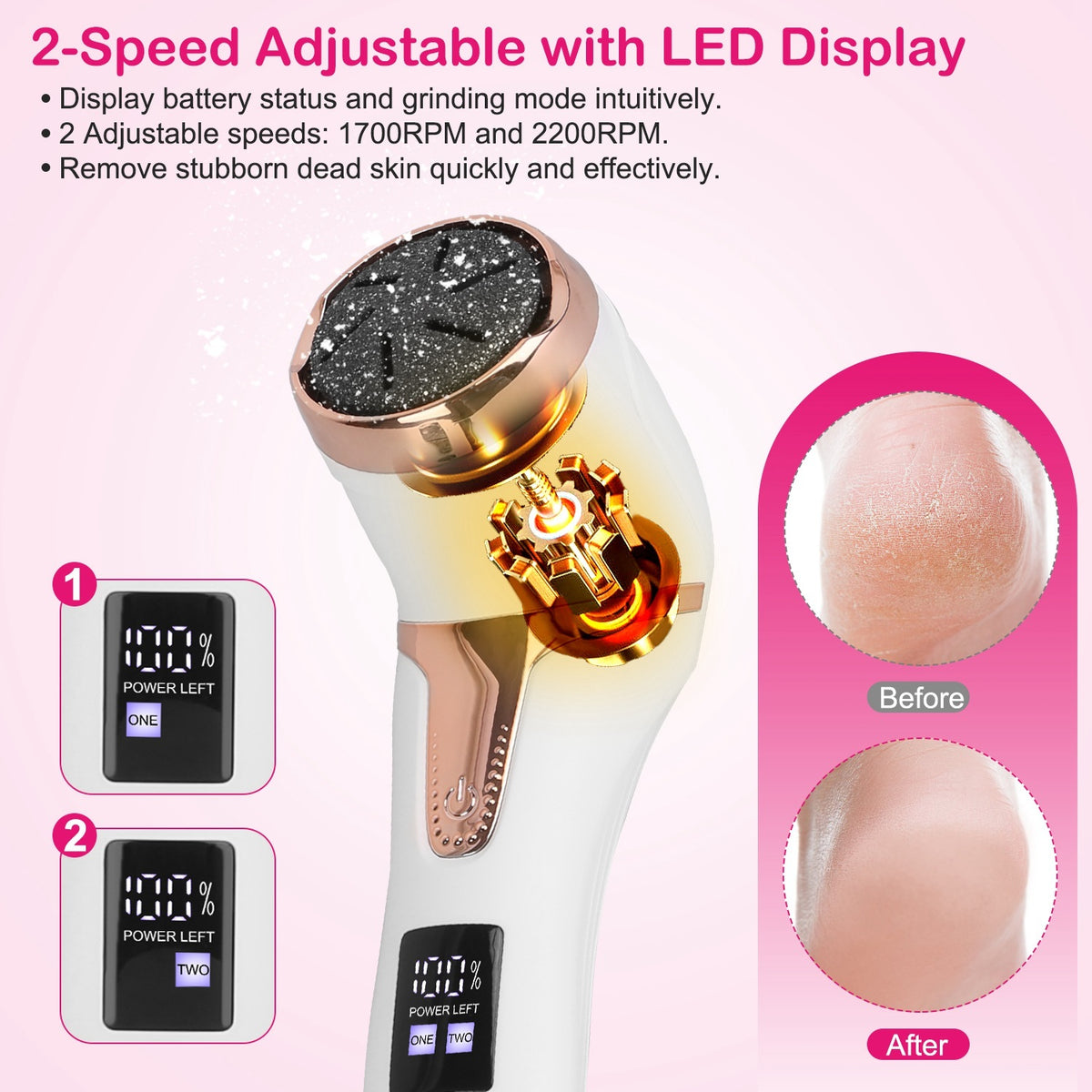 Electric Foot Callus Remover